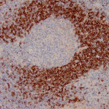 Anti-IgD antibody IHC human lymph node STJ180611