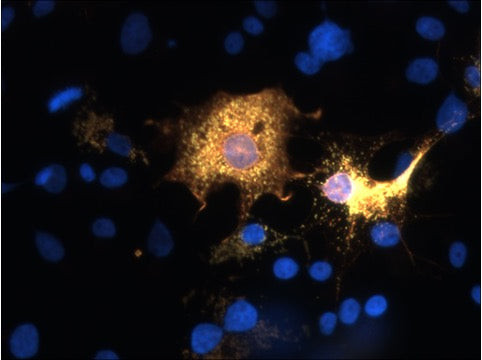 ICC staining SARM1 in transfected COS-7 cells using antibody with DAPI nuclear counterstain STJA0004904