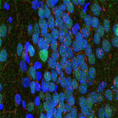 IHC staining rat hippocampus section using anti-adenylate cyclase III antibody STJA0003569