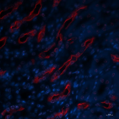 IF staining mouse kidney inner medulla AQP2 phospho-Ser269 labeling using antibody STJA0003582