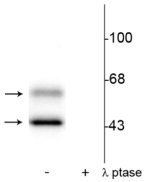 Western blot phospho-CaM Kinase II detection in rat brain lysate with phosphatase control STJA0003589