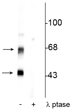Western blot phosphorylated CaM Kinase II in rat brain lysate with phosphatase control STJA0003590