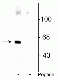 Western blot Che-1 protein phosphorylated at Ser477 in HeLa cell lysate STJA0003595