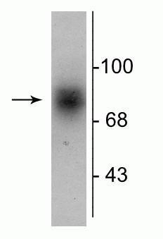 Western blot 88 kDa DAT protein immunolabeling in human striatal lysate STJA0003616