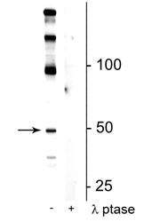 Western blot eEF1A2 phospho-Ser358 detection in mouse hippocampal lysate STJA0003624