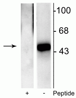 Western blot phospho-Elk-1 Ser383 immunolabeling with phosphopeptide competition STJA0003626