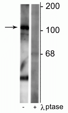 Western blot GABAB R1 phospho-Ser923 immunolabeling with phosphatase control STJA0003653