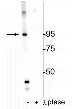 Western blot phosphorylated IR protein at Thr1160 in HeLa cell lysate with phosphatase control STJA0003672