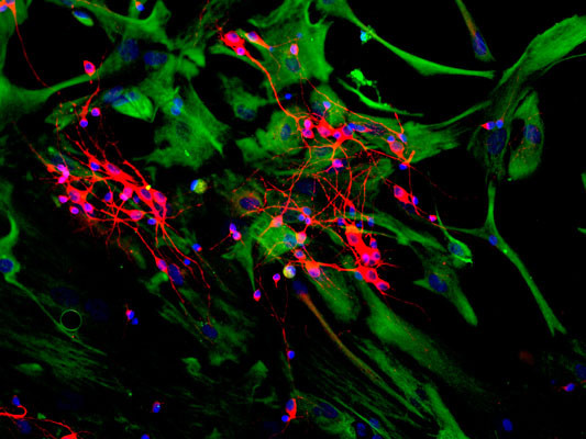 Anti-MAP2 antibody 2C4 ICC neuronal dendrites STJA0003677
