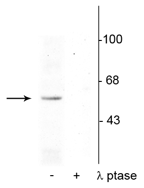 Western blot p53 Ser392 phosphorylation in rat brain with lambda phosphatase control STJA0003735