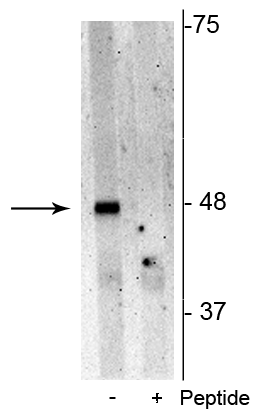 Western blot p62 Ser28 phospho-specific immunolabeling in Jurkat cell lysate STJA0003736