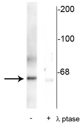 Western blot PLK protein phosphorylated at Thr210 in rat synaptic membrane STJA0003749