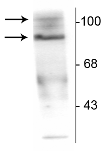 Western blot using antibody PR-A and PR-B isoforms phosphorylated progesterone receptor STJA0003755