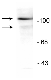 Western blot PR-A and PR-B isoforms phosphorylated progesterone receptor in T47D cells STJA0003756