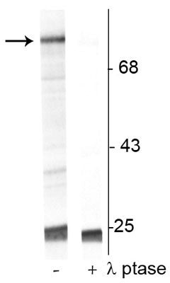 Western blot phosphorylated Raf-1 protein at Ser301 in UV-treated Jurkat cell lysate STJA0003762