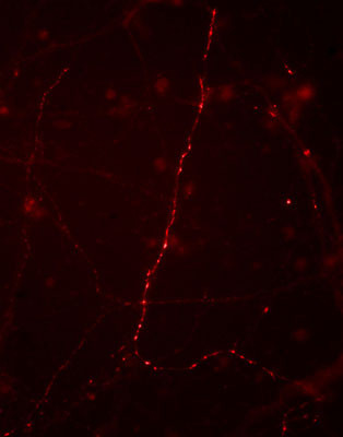 IHC staining mouse caudate neurons synapsin I phosphorylated at Ser9 using antibody STJA0003783
