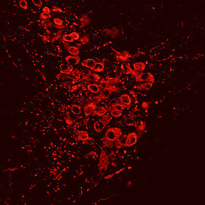 IHC staining mouse locus coeruleus tyrosine hydroxylase labeled with antibody red STJA0003817