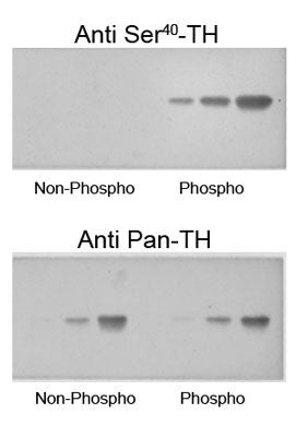 WB analysis phospho-TH Ser40 selective immunolabeling at 60 kDa STJA0003819