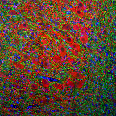 IHC staining rat brain stem section with MAP2 antibody neuronal perikarya and dendrites STJA0003848