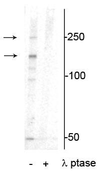 Western blot XIRP1 phospho-Ser295 detection in mouse heart lysate with phosphatase control STJA0003857