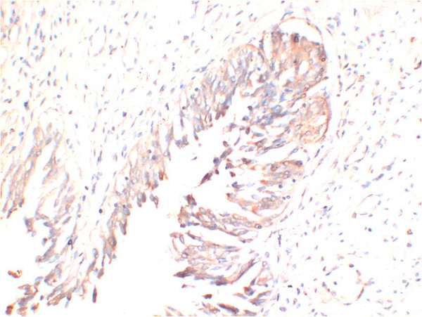Immunohistochemical analysis of paraffin-embedded Human ProstateTissue using AMPK γ1 mouse Monoclonal antibody diluted at 1:200.