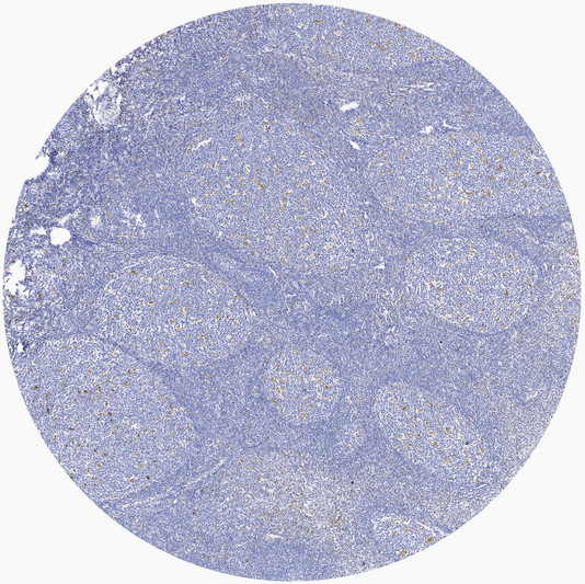Immunohistochemical analysis of paraffin-embedded human tonsil, primary antibody was diluted at 1:200. Secondary STJ196750
