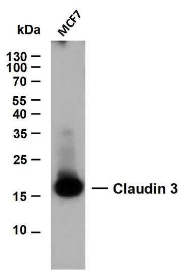 Western Blot (WB): Whole cell lysates were separated by 12% SDS-PAGE, and the membrane was blotted with anti-Claudin 3 STJ196828
