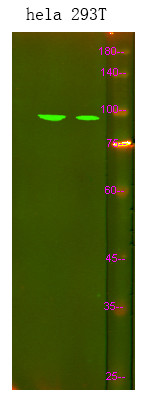 Western Blot analysis of hela 293T using primary antibody at 1:1000 dilution 4°C, overnight. Secondary antibody (STJS000791) was diluted at 1:10000 25°C, 1. 5hours