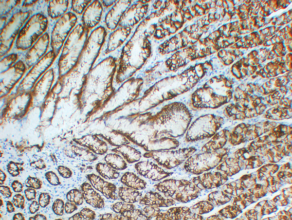 Immunohistochemistry - Paraffin (IHC-P): Human stomach tissue was stained with Anti-CA IX (PTR2373) Antibody. STJA0006249