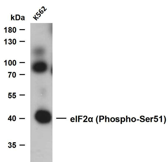 Western Blot (WB): Whole cell lysates were separated by 10% SDS-PAGE, and the membrane was blotted with anti-eIF2α STJA0006271