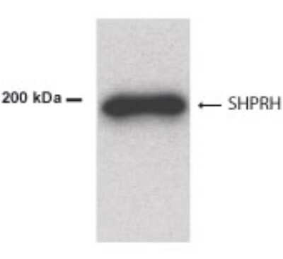 Western Blot analysis mouse brain lysate demonstrating SHPRH immunolabeling STJA0005758