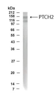 Western Blot specific PTCH2 immunolabeling in human fetal brain lysate STJA0005680
