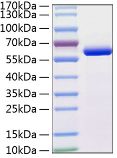 Human MMP-13 protein (Recombinant) (C-His) (STJP000993)