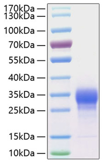 Human IL-7 protein (Recombinant) (C-His) (STJP001120)