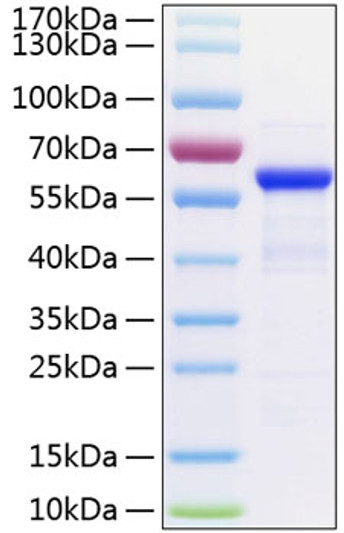 Human TET2 protein (Recombinant) (Please contact us for more information.) (STJP001260)