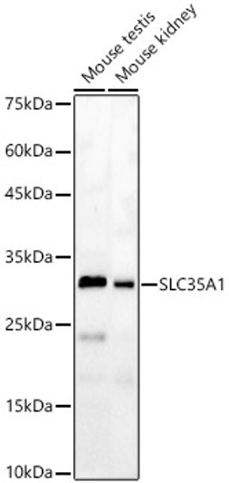 Anti-SLC35A1 antibody (1-100) (STJ11103817)