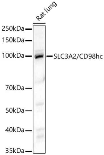 Western blot analysis of lysates from Rat lung, using SLC3A2/CD98hc Rabbit polyclonal antibody (STJ11103936) at 1:1000 dilution. Secondary antibody: HRP Goat Anti-Rabbit IgG (H+L) (STJS000856) at 1:10000 dilution. Lysates/proteins: 25 Mu g per lane. Blocking buffer: 3% nonfat dry milk in TBST. Detection: ECL Basic Kit. Exposure time: 60s. Western blot analysis of lysates from Rat lung, using SLC3A2/CD98hc Rabbit polyclonal antibody (STJ11103936) at 1:1000 dilution. Secondary antibody: HRP Goat Anti-Rabbit IgG (H+L) (STJS000856) at 1:10000 dilution. Lysates/proteins: 25 Mu g per lane. Blocking buffer: 3% nonfat dry milk in TBST. Detection: ECL Basic Kit. Exposure time: 60s.