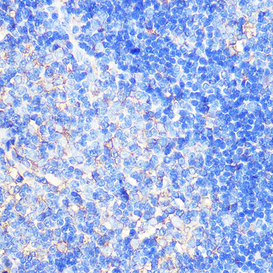 Immunohistochemistry analysis of XCR1 in paraffin-embedded rat thymus using XCR1 Rabbit polyclonal antibody (STJ11103950) at dilution of 1:100 (40x lens). Perform microwave antigen retrieval with 10 mM Tris/EDTA buffer pH 9. 0 before commencing with immunohistochemistry staining protocol.