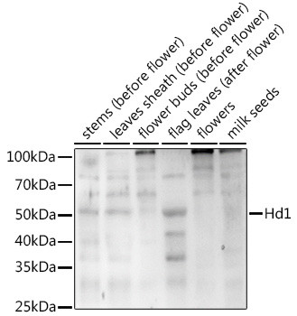 Western blot analysis of extracts of various tissues from the japonica rice (Oryza sativa L. ) variety Zhonghua 11, using Hd1 Rabbit polyclonal antibody (STJ11103952) at 1:1000 dilution. Secondary antibody: HRP Goat Anti-Rabbit IgG (H+L) (STJS000856) at 1:10000 dilution. Lysates/proteins: 25 Mu g per lane. Blocking buffer: 3% nonfat dry milk in TBST. Detection: ECL Enhanced Kit. Exposure time: 120s.