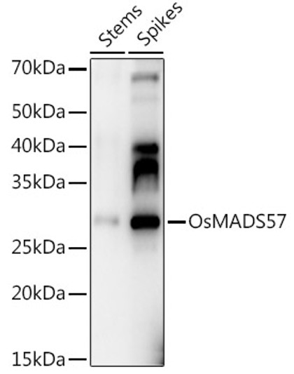 Western blot analysis of extracts of various tissues from the japonica rice (Oryza sativa L. ) variety Zhonghua 11, using OsMADS57 Rabbit polyclonal antibody (STJ11104038) at 1:1000 dilution. Secondary antibody: HRP Goat Anti-Rabbit IgG (H+L) (STJS000856) at 1:10000 dilution. Lysates/proteins: 25 Mu g per lane. Blocking buffer: 3% nonfat dry milk in TBST. Detection: ECL Enhanced Kit. Exposure time: 10s.