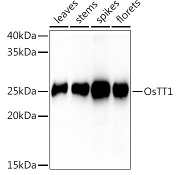 Western blot analysis of extracts of various tissues from the japonica rice (Oryza sativa L. ) variety Zhonghua 11, using OsTT1 Rabbit polyclonal antibody (STJ11104055) at 1:1000 dilution. Secondary antibody: HRP Goat Anti-Rabbit IgG (H+L) (STJS000856) at 1:10000 dilution. Lysates/proteins: 25 Mu g per lane. Blocking buffer: 3% nonfat dry milk in TBST. Detection: ECL Basic Kit. Exposure time: 60s.