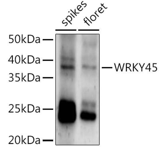 Western blot analysis of extracts of various tissues from the japonica rice (Oryza sativa L. ) variety Zhonghua 11, using WRKY45 Rabbit polyclonal antibody (STJ11104071) at 1:1000 dilution. Secondary antibody: HRP Goat Anti-Rabbit IgG (H+L) (STJS000856) at 1:10000 dilution. Lysates/proteins: 25 Mu g per lane. Blocking buffer: 3% nonfat dry milk in TBST. Detection: ECL Enhanced Kit. Exposure time: 60s.