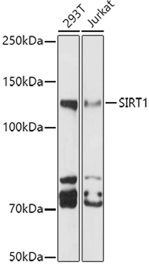 Western blot analysis of various lysates using SIRT1 Rabbit polyclonal antibody (STJ11104332) at 1:1000 dilution. Secondary antibody: HRP Goat Anti-Rabbit IgG (H+L) (STJS000856) at 1:10000 dilution. Lysates/proteins: 25 Mu g per lane. Blocking buffer: 3% nonfat dry milk in TBST. Detection: ECL Basic Kit. Exposure time: 30s.