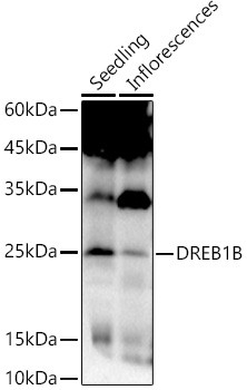 Western blot analysis of extracts of various tissues from Arabidopsis thaliana, using DREB1B Rabbit polyclonal antibody (STJ11104616) at 1:1000 dilution. Secondary antibody: HRP Goat Anti-Rabbit IgG (H+L) (STJS000856) at 1:10000 dilution. Lysates/proteins: 25 Mu g per lane. Blocking buffer: 3% nonfat dry milk in TBST. Detection: ECL Basic Kit. Exposure time: 30s.