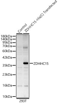 Western blot analysis of lysates from wild type (WT) and 293T cells transfected with ZDHHC15 Rabbit pAb, using ZDHHC15 Rabbit polyclonal antibody (STJ11105341) at 1:1000 dilution. Secondary antibody: HRP Goat Anti-Rabbit IgG (H+L) (STJS000856) at 1:10000 dilution. Lysates/proteins: 25ug per lane. Blocking buffer: 3% nonfat dry milk in TBST. Detection: ECL Basic Kit. Exposure time: 60s.