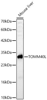 Western blot analysis of lysates from Mouse liver using TOMM40L Rabbit polyclonal antibody (STJ11105460) at 1:2000 dilution. Secondary antibody: HRP Goat Anti-Rabbit IgG (H+L) (STJS000856) at 1:10000 dilution. Lysates/proteins: 25  Mu g per lane. Blocking buffer: 3% nonfat dry milk in TBST. Detection: ECL Basic Kit. Exposure time: 90s.