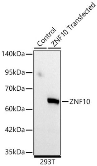 Western blot analysis of lysates from wild type (WT) and 293T cells transfected with ZNF10 using ZNF10 Rabbit polyclonal antibody (STJ11105608) at 1:1000 dilution. Secondary antibody: HRP Goat Anti-Rabbit IgG (H+L) (STJS000856) at 1:10000 dilution. Lysates/proteins: 25  Mu g per lane. Blocking buffer: 3% nonfat dry milk in TBST. Detection: ECL Basic Kit. Exposure time: 60s.