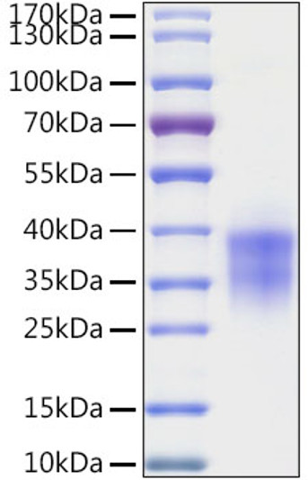 Human Granzyme B protein (Recombinant) (C-His) (STJP002459)