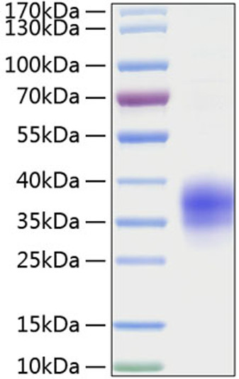 Recombinant Mouse TNFRSF1A/TNF-R1/CD120a Protein was determined by SDS-PAGE with Coomassie Blue, showing a band at 35-38 kDa.