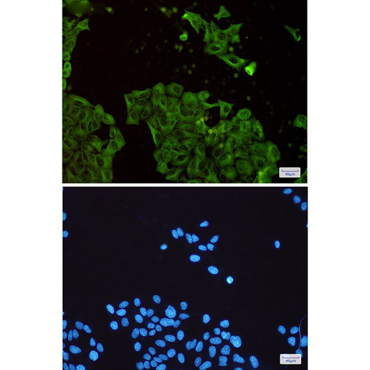 beta tubulin antibody immunocytochemistry HeLa STJA0010485